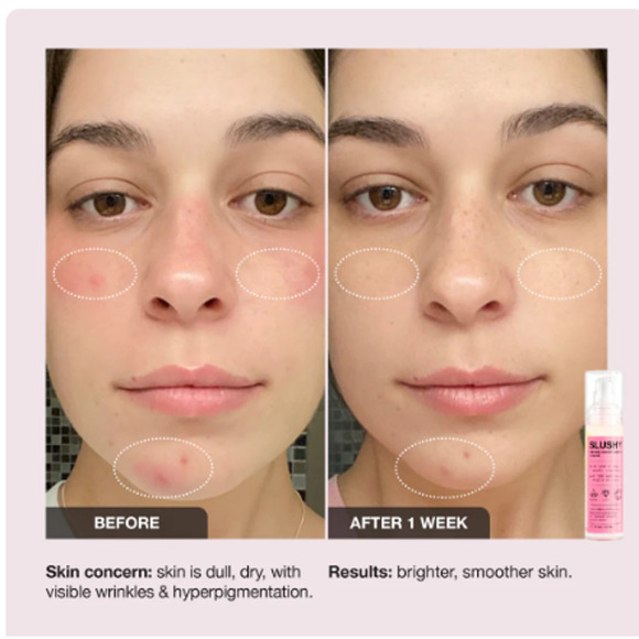 Innbeauty Project Slushy Serum Moisturizer 1.7 oz (MSRP $32) - Picture 2 of 4